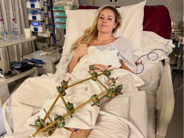 Após grave lesão nas Olimpíadas, estrela do esqui alpino choca com foto após cirurgias