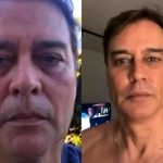 Veja antes e depois de Marcello Antony após harmonização: “Gostei bastante”