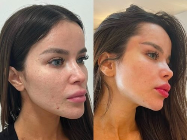 Treta no mundo da beleza: Dentista expõe Bianca Anchieta após suposta parceria malsucedida