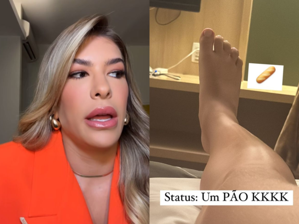 Lore mostra pé inchado entre compromissos e revela plano para amenizar dores