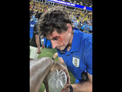 Uruguai e Colômbia, pela semifinal da Copa América, terminou em pancadaria generalizada (Reprodução)