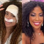 Marvvila passa por cirurgias após descobrir tumor no ouvido: “Em processo de recuperação”