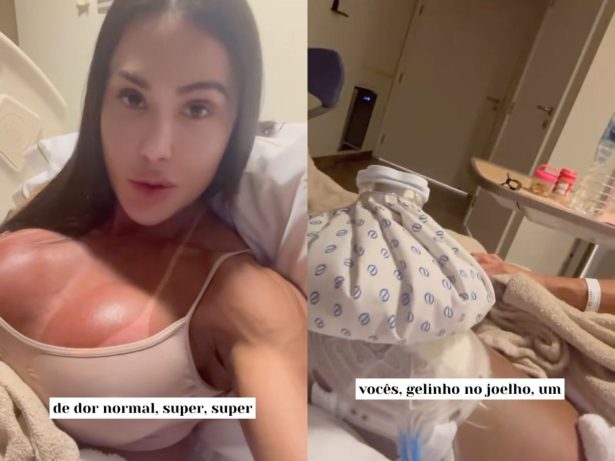Internada após lesão, Gracyanne Barbosa mostra corpo inchado e atualiza fãs sobre saúde
