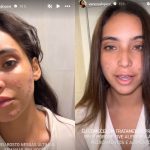 De cara limpa, Vanessa Lopes desabafa sobre acne e saúde mental