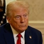 Especialista detalha condição que afeta Donald Trump e orienta sobre cuidados