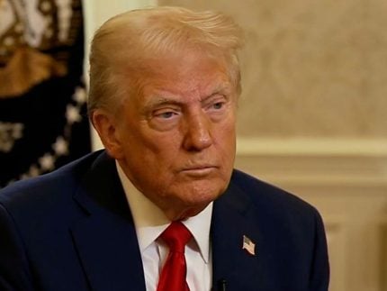 Especialista detalha condição que afeta Donald Trump e orienta sobre cuidados