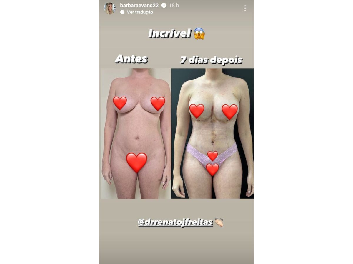 Reprodução Instagram