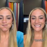 Luisa Périssé tem paralisia facial nos bastidores de gravação de programa