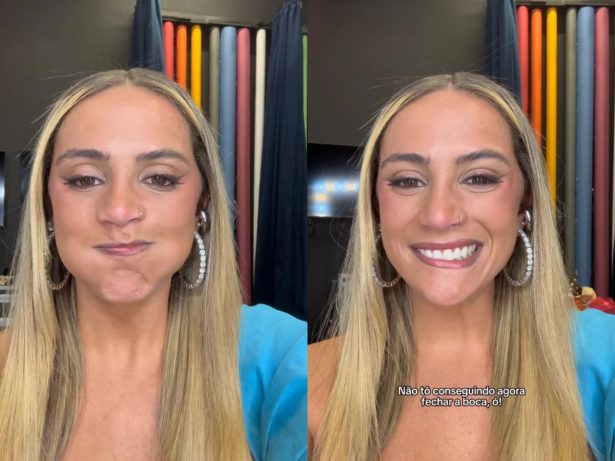 Luisa Périssé tem paralisia facial nos bastidores de gravação de programa