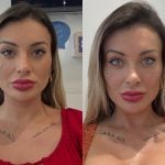 Andressa Urach antes e depois