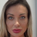 Após Urach reclamar de complicações, especialista alerta sobre mudança de cor dos olhos