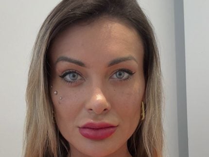 Após Urach reclamar de complicações, especialista alerta sobre mudança de cor dos olhos