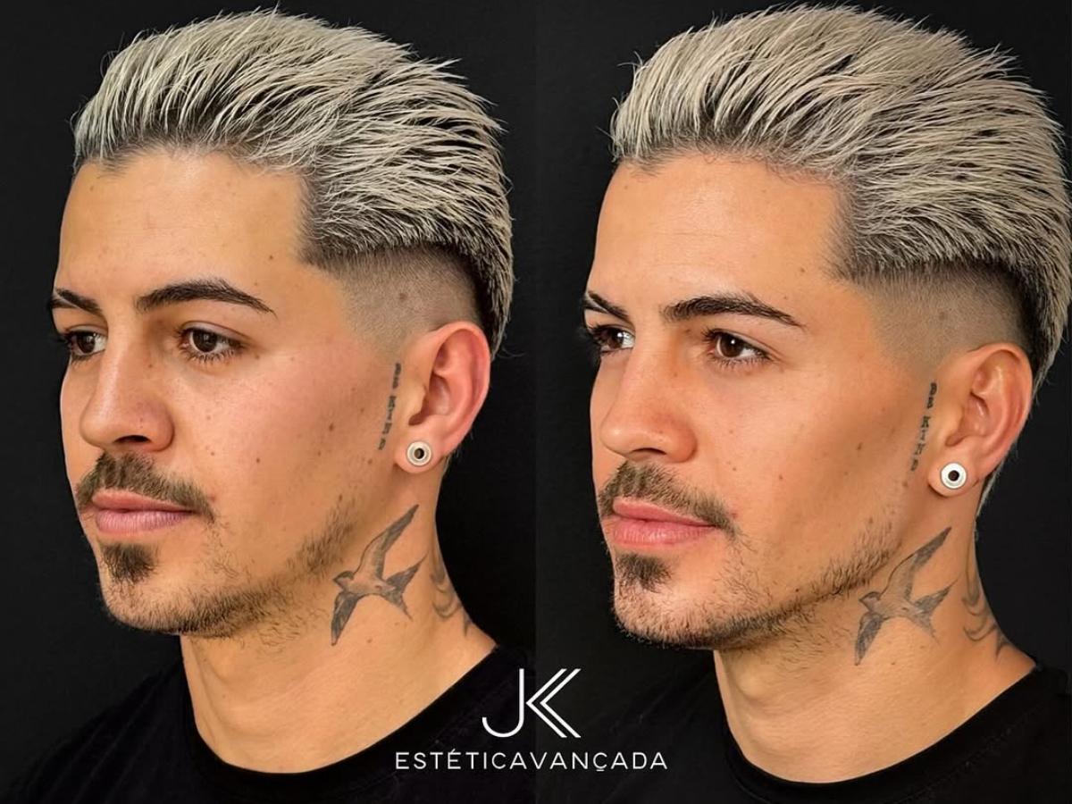 Biel - Divulgação/JK Estética Avançada