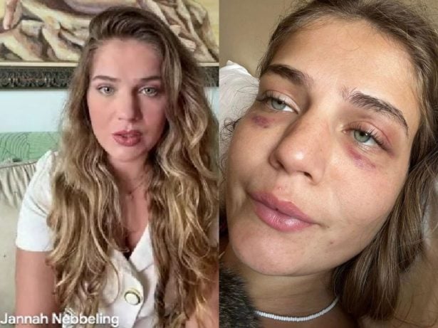 Ex de Jorge Báez denuncia violência psicológica e física: “Ele me sufocou”; ex-jogador é procurado