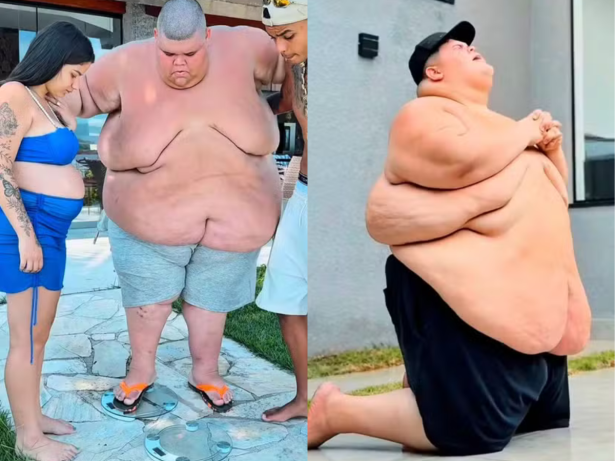 Influenciador Gordão da XJ perde mais de 115 kg e bate meta de peso para fazer bariatrica