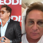 “Caí com a cara no chão, tava mamado!”: Leonardo diverte ao relembrar queda e olho roxo