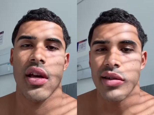 Cantor Nilo anuncia pausa na carreira após diagnóstico de paralisia de Bell