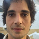 Fiuk surpreende com novo visual após harmonização facial; Veja o antes e depois!