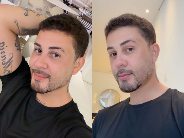 Carlinhos Maia reaparece após sumiço das redes e revela resultado de cirurgia estética