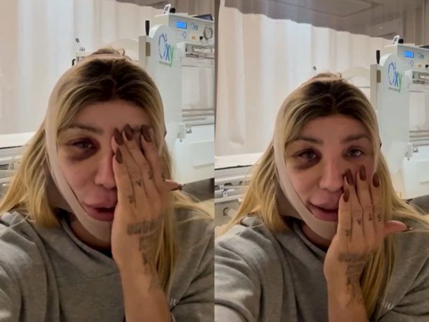 Saiba qual foi o novo procedimento de Maya Massafera