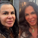 Após perder cabelo, Gretchen troca a prótese capilar. Veja antes e depois!