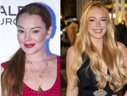 Lindsay Lohan choca fãs com visual rejuvenescido: “Quando a plástica é bem feita”