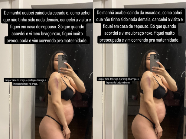 Grávida, Raissa Barbosa cai da escada e vai à emergência do hospital: “Preocupada”