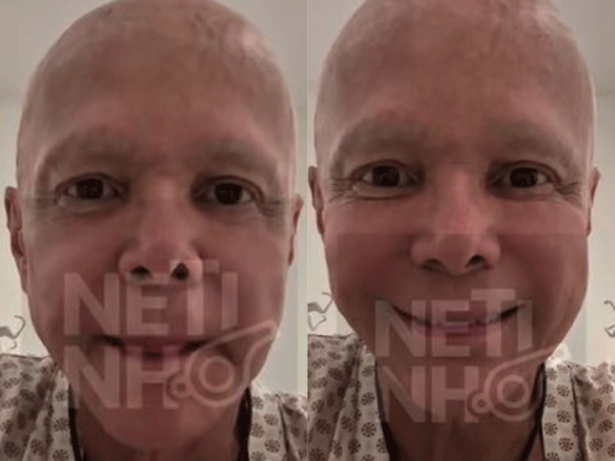 Netinho explica variação de peso durante tratamento contra câncer