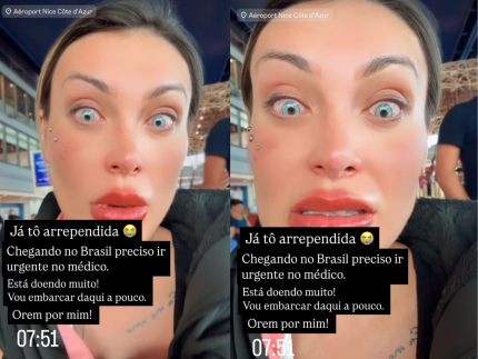 Andressa Urach revela complicação após alterar a cor dos olhos: “Já tô arrependida”