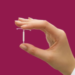 Diu Mirena: Contraceptivo passa a ser válido por 8 anos, segundo aprovação a Anvisa