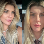Íris Stefanelli mostra rosto após plástica: “Um dos maiores investimentos que já fiz”