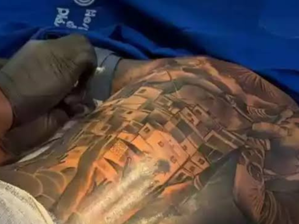 Tatuagem com anestesia: especialista avalia riscos após proibição do CFM