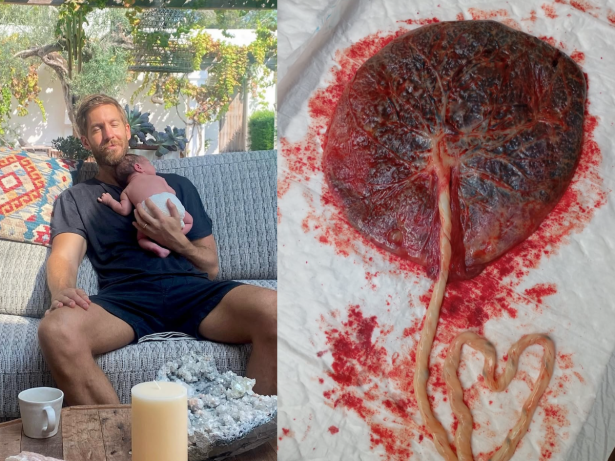 Calvin Harris anuncia nascimento do 1º filho e surpreende ao transformar placenta em cápsulas