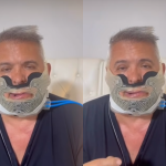 Orlando Morais faz cirurgia para tratar apneia do sono: “62 anos sem dormir direito”