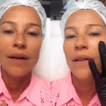 Dia de beleza: Luana Piovani faz preenchimento facial durante passagem pelo Brasil