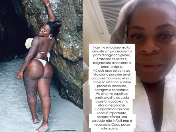 Jojo se emociona ao fazer procedimento nos glúteos: “Para me sentir maravilhosa”