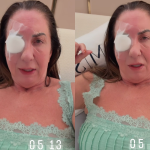 Mãe de Virginia relata crise de ansiedade após cirurgia no olho: “Falta de ar, angústia e medo”