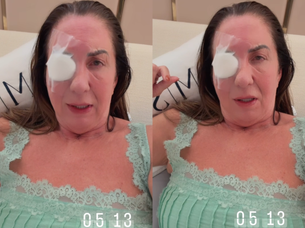 Mãe de Virginia relata crise de ansiedade após cirurgia no olho: “Falta de ar, angústia e medo”