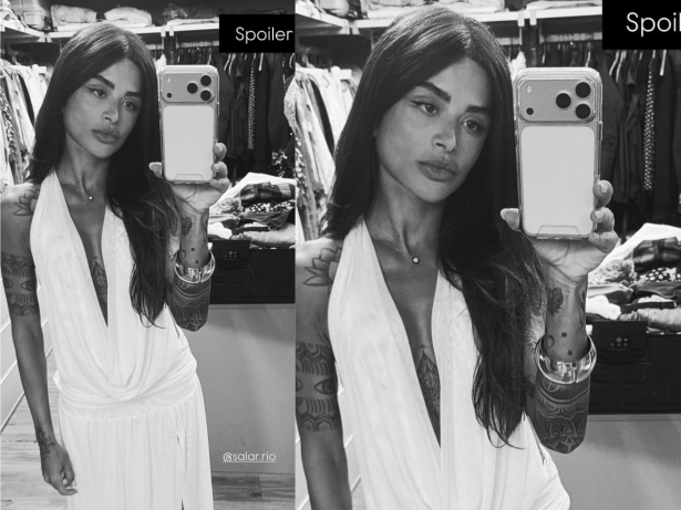 Ex-BBB Aline Campos revela que foi liberada para Carnaval após cirurgia: “Não estarei 100%”
