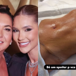 Mãe de Virginia impressiona ao exibir barriga chapada após cirurgias plásticas