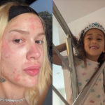 Karoline Lima mostra rosto após procedimento e filha pede maquiagem: “Fazer outra em você”