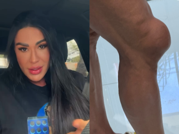 Gracyanne Barbosa revela drama físico e emocional para seguir no “Dança dos Famosos”