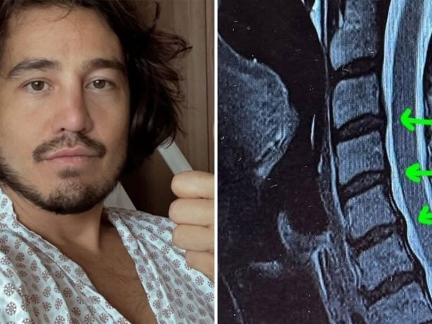 Tiago Iorc é internado às pressas por grave crise de hérnia e atualiza estado de saúde