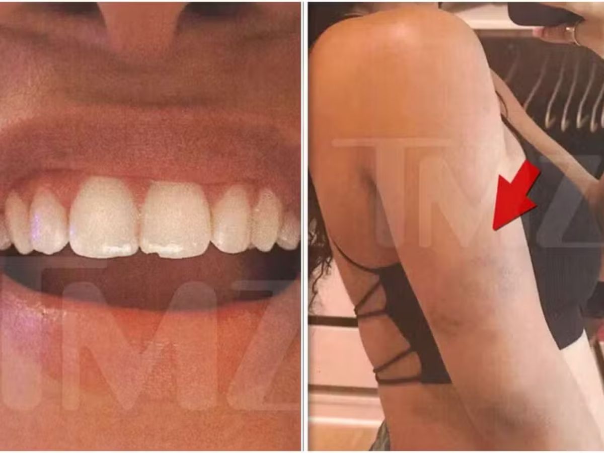 Reprodução TMZ