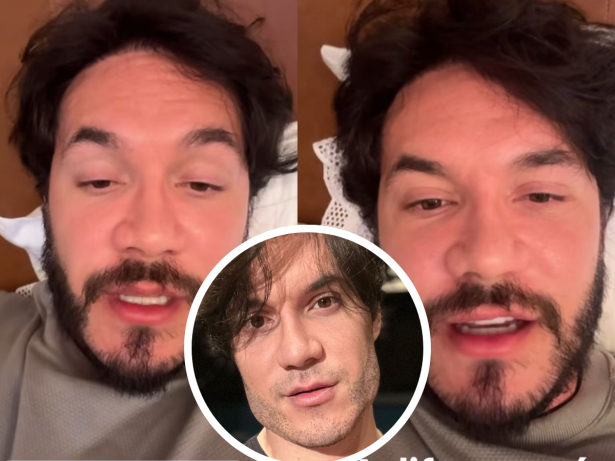 Eliezer explica motivação para tirar harmonização facial: “Rosto deformado”