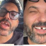 Edson perde dente antes de show e Hudson não perdoa: “Onde tem um dentista urgente?”