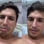 Ex-BBB Felipe Prior é internado com infecção e surge com o olho estourado. Veja!