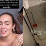 Que perigo! Ex-BBB Larissa Santos sofre acidente doméstico e leva 14 pontos no pé