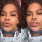 Ex-Big Brother sofre acidente e desabafa sobre falta de socorro: ‘’Deixada para morrer”