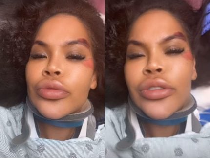 Ex-Big Brother sofre acidente e desabafa sobre falta de socorro: ‘’Deixada para morrer”
